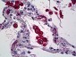 Mannose Receptor / CD206 Antibody (clone 5C11)